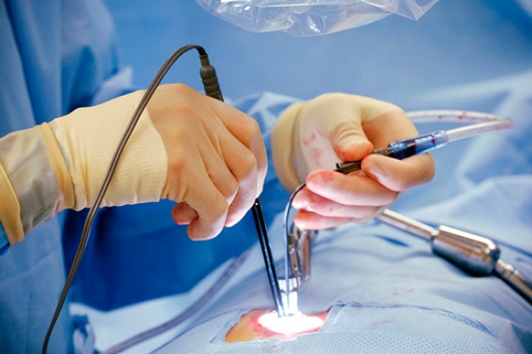 سندرم جراحی کمر ناموفق چیست؟