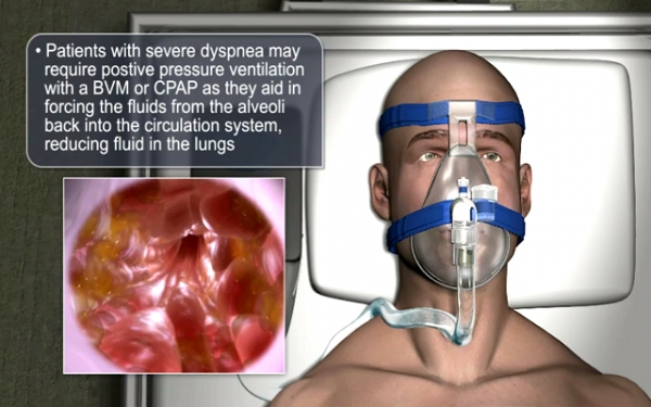 اورژانس تنفس ؛ چگونگی برخورد با آسیب های ریوی و نکات اعزام 