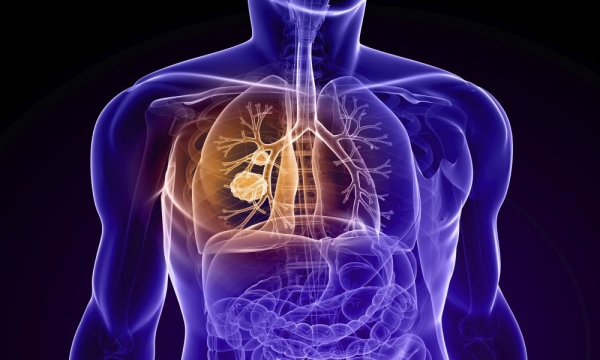 اطلاعاتی درباره بیماری های مزمن انسداد ریه (COPD)