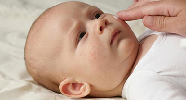 بیماری روزئولا در نوزادان و کودکان:علل،علائم و درمان